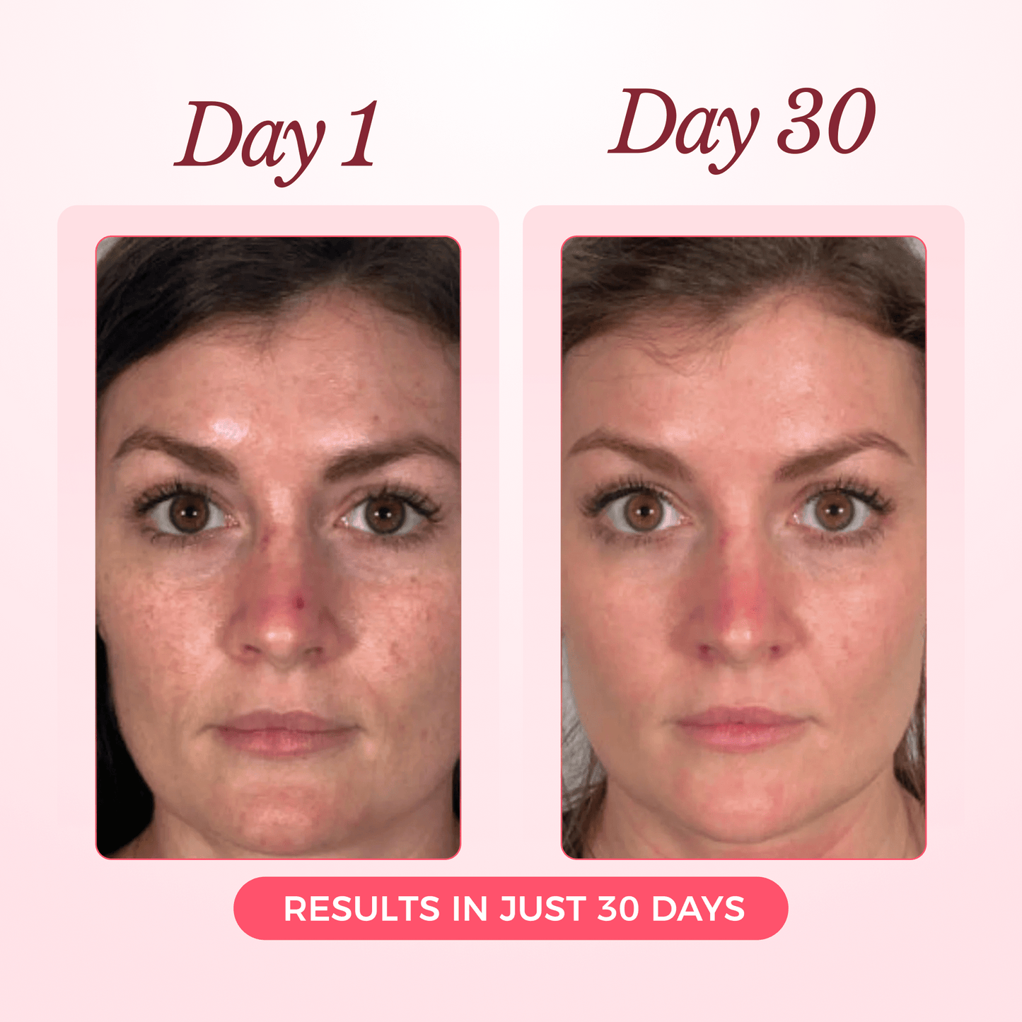 Collagen Glow Up Mask 2.0 - 90 Day Supply (8 Masks + 4 FREE!)