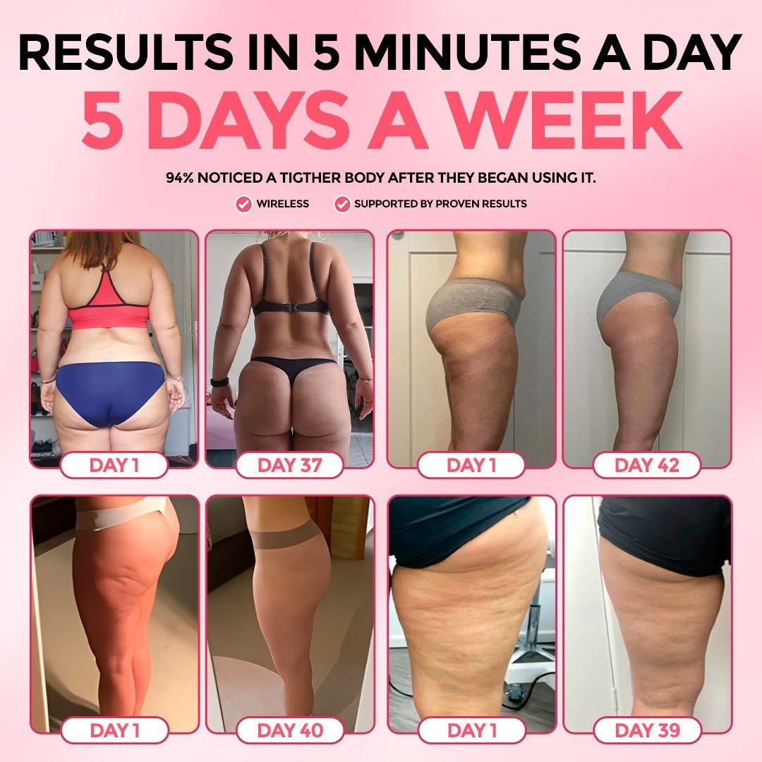 SheVitality™  Cellulite Relief Kit